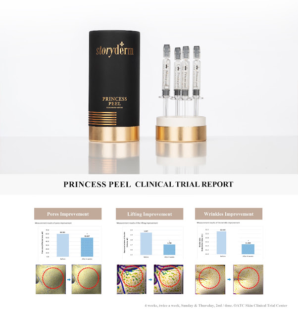 Storyderm Launches the Renewed Gold Micro Needle Therapy “Princess Peel”